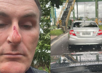 O PM afirma que, mesmo trajando fardamento completo, foi atingido por socos. Foto: Reprodução