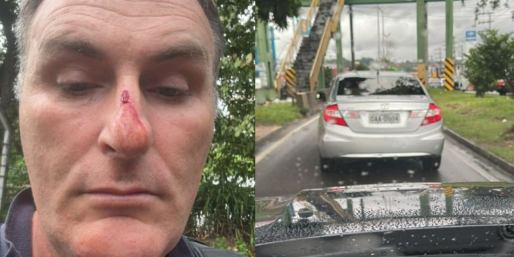 O PM afirma que, mesmo trajando fardamento completo, foi atingido por socos. Foto: Reprodução