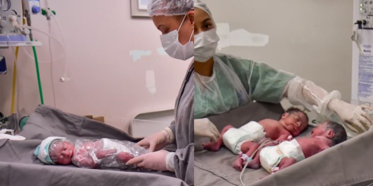 Parto raro: mulher dá à luz três bebês em maternidade da zona leste de Manaus