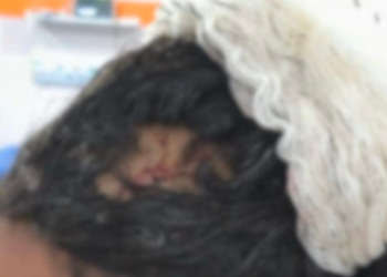 Pessoas que passavam pelo local no momento do ataque prestaram socorro à jovem. Foto: Reprodução