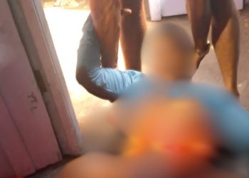 Após discussão com mulher, homem leva f4cada no abdômen e fica com intestino exp0sto em Maués
