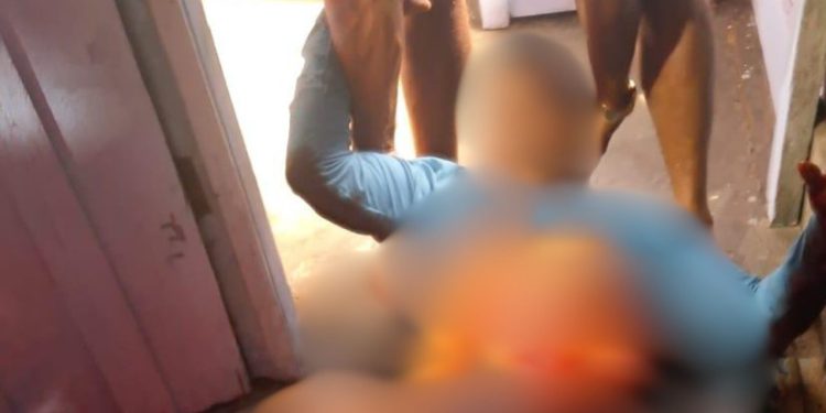 Após discussão com mulher, homem leva f4cada no abdômen e fica com intestino exp0sto em Maués
