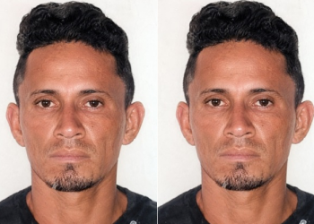 O homem foi socorrido e submetido a procedimento cirúrgico em razão da gravidade das lesões. Foto: Divulgação/PC-AM