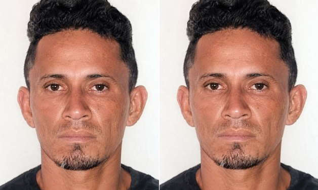 O homem foi socorrido e submetido a procedimento cirúrgico em razão da gravidade das lesões. Foto: Divulgação/PC-AM