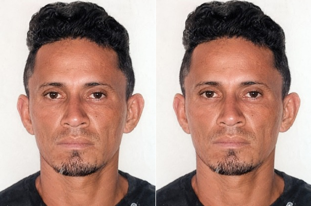 O homem foi socorrido e submetido a procedimento cirúrgico em razão da gravidade das lesões. Foto: Divulgação/PC-AM