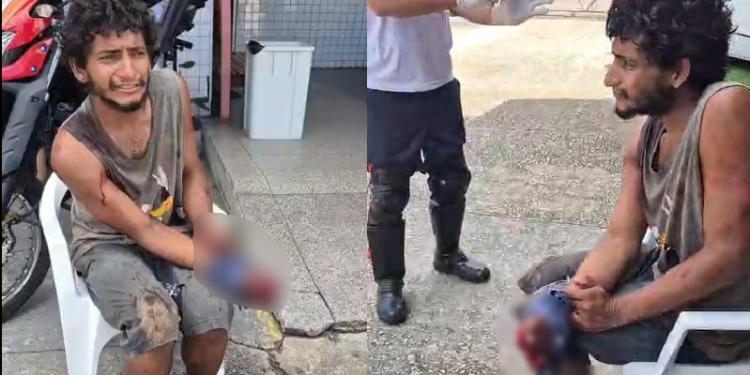 O jovem foi submetido à violência extrema como forma de castigo. Foto: Reprodução