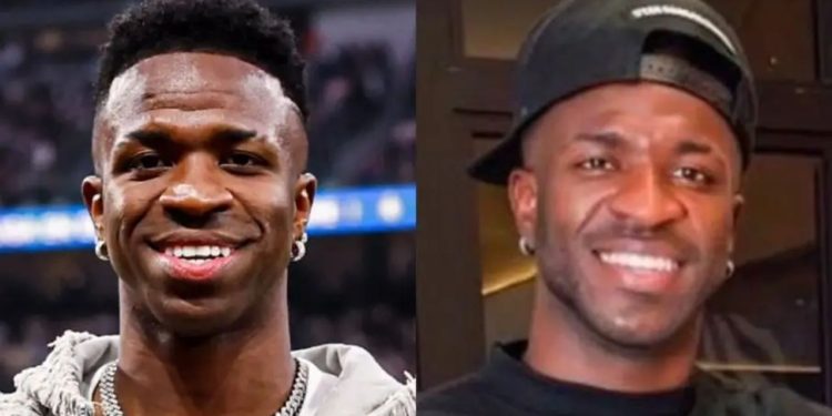 Harmonização facial de Vinicius Júnior divide opiniões e viraliza nas redes