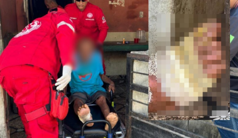 Imagem forte: suspeit0s são pres0s por deixarem idoso ferid0 e saírem para sacar benefício dele no Amazonas