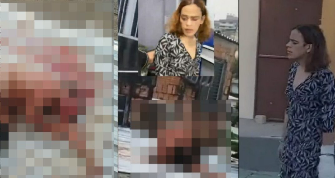 Vídeos inéditos mostram idoso ag0nizando após ter olhos e orelhas arrancad0s pela enteada em Manaus