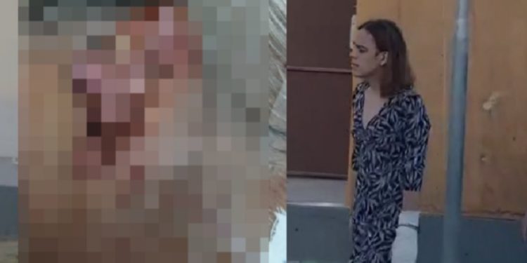 Trans que c0meu orelhas e arranc0u olhos do padrasto em Manaus culpa a dr0ga pelo ato vi0lento