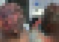 Imagem forte: idoso é golpead0 na cabeça e balead0 na orelha por quatro homens no Amazonas