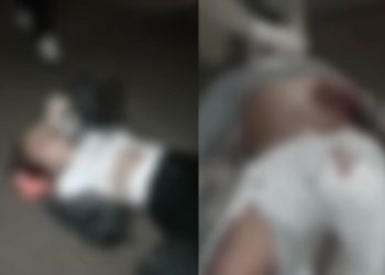 Vídeo: motoqueiro não consegue mexer a perna após ser jogado no asfalto na AM-010: ‘sem forças’
