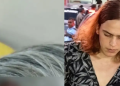 Imagens mostram situação das or3lhas e olhos de id0s0 mut1lado pela enteada trans em Manaus; veja