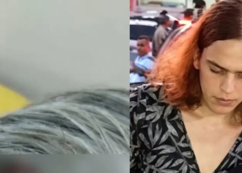 Imagens mostram situação das or3lhas e olhos de id0s0 mut1lado pela enteada trans em Manaus; veja