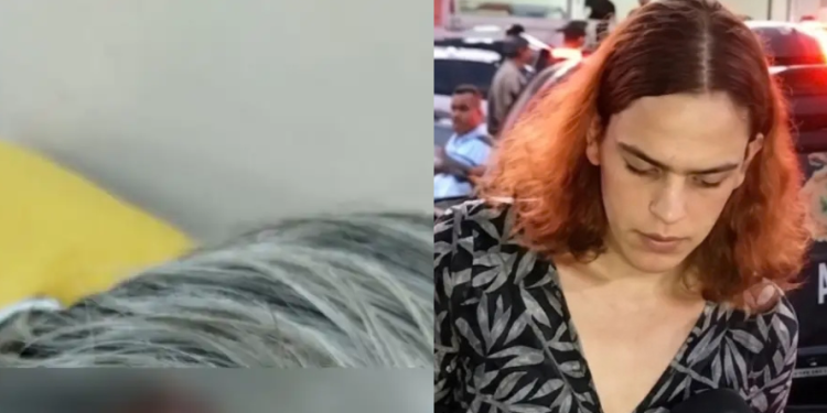 Imagens mostram situação das or3lhas e olhos de id0s0 mut1lado pela enteada trans em Manaus; veja