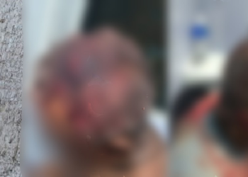 Liderança comunitária de 67 anos é agredida e bal3ada em Tapauá
