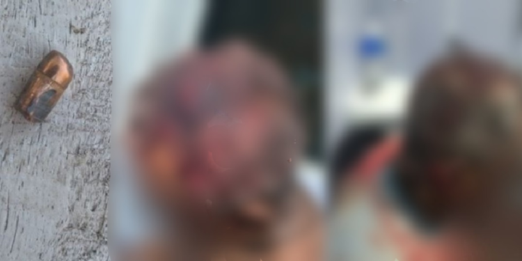 Liderança comunitária de 67 anos é agredida e bal3ada em Tapauá