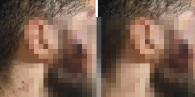 Motorista de aplicativo é perseguido e tem rosto dilacerad0 após colisão no Distrito