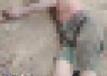 Imagem forte: m0rto no ramal da AM-010 tem feriment0 na cabeça
