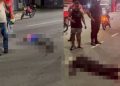 Vídeo: colisão deixa passageira de moto com o pé quase amputad0 em Manaus
