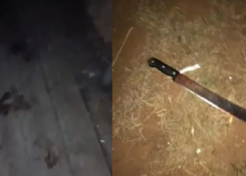 Vídeo: Mulher é hospitalizada ao ter a mão d3c3pad@ pelo marido durante br1ga