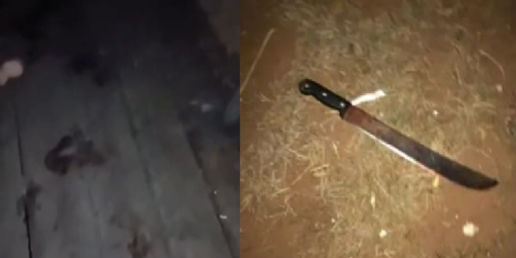 Vídeo: Mulher é hospitalizada ao ter a mão d3c3pad@ pelo marido durante br1ga