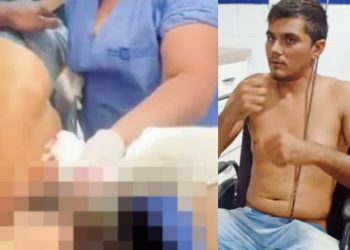 Vídeo: pescador é atendido na UBS com arpão de pesca na cabeça